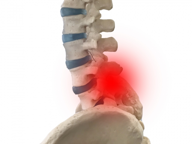 脊柱管狭窄症　腰痛